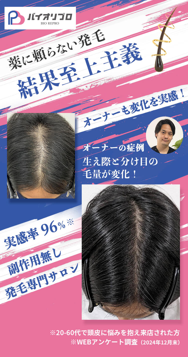 薬に頼らない発毛 結果至上主義