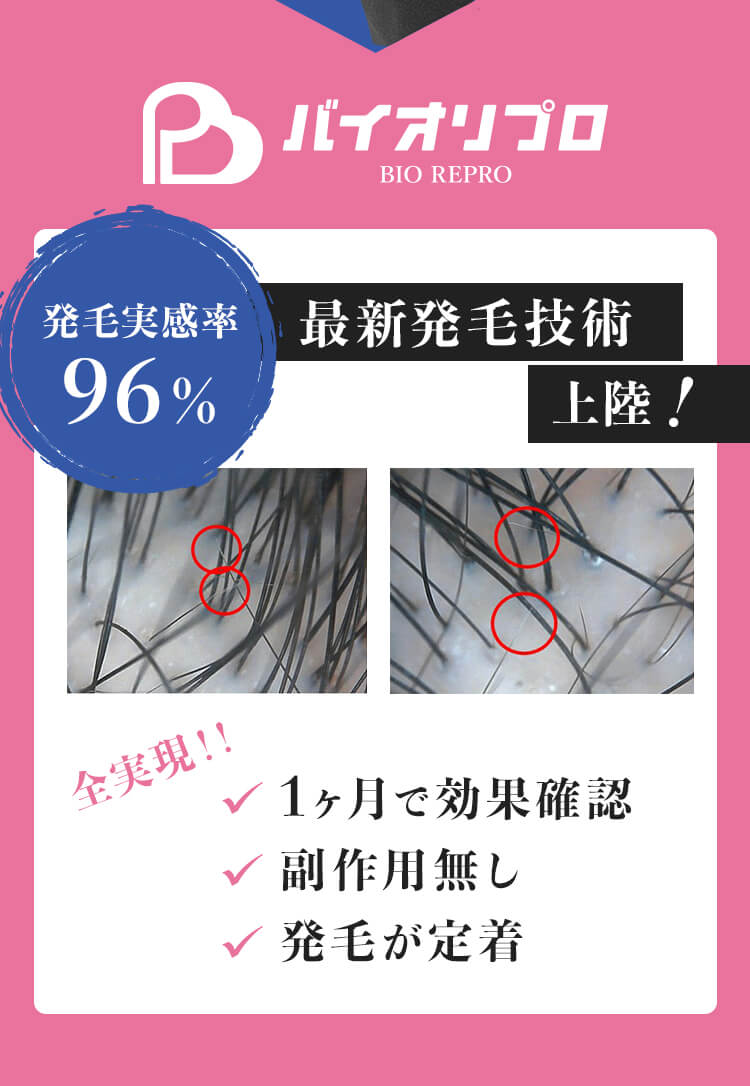 最新発毛技術上陸！